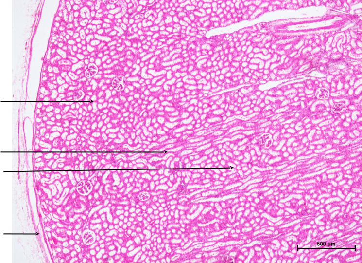 Bronchus